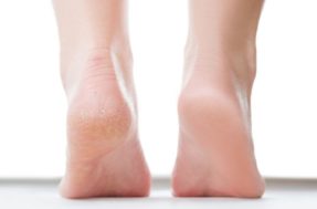 Início do diabetes: sintomas podem começar pelos pés