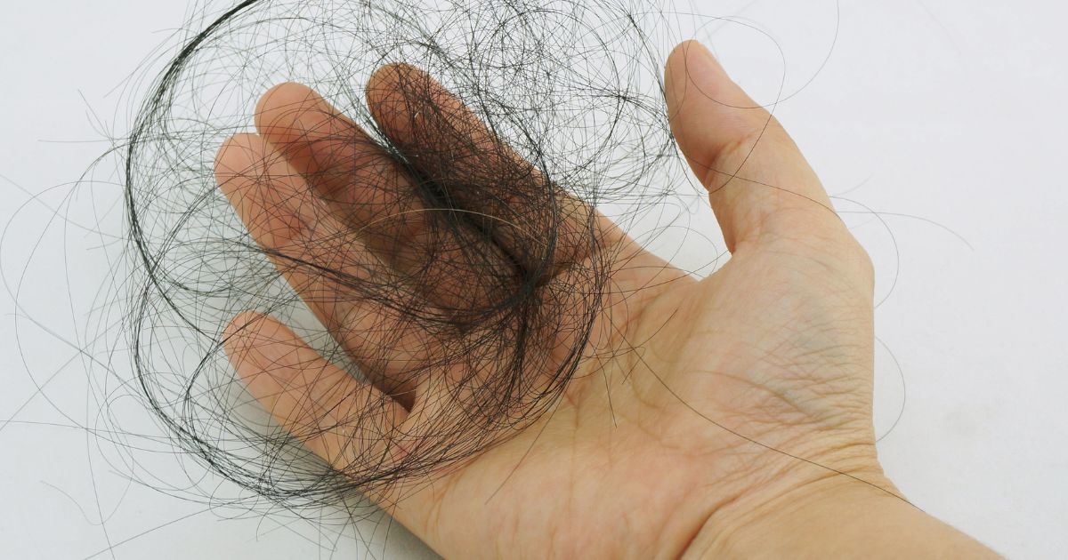 ¡Adiós a la caída del cabello!  Deja de comer esto y recupera la salud de tu cabello