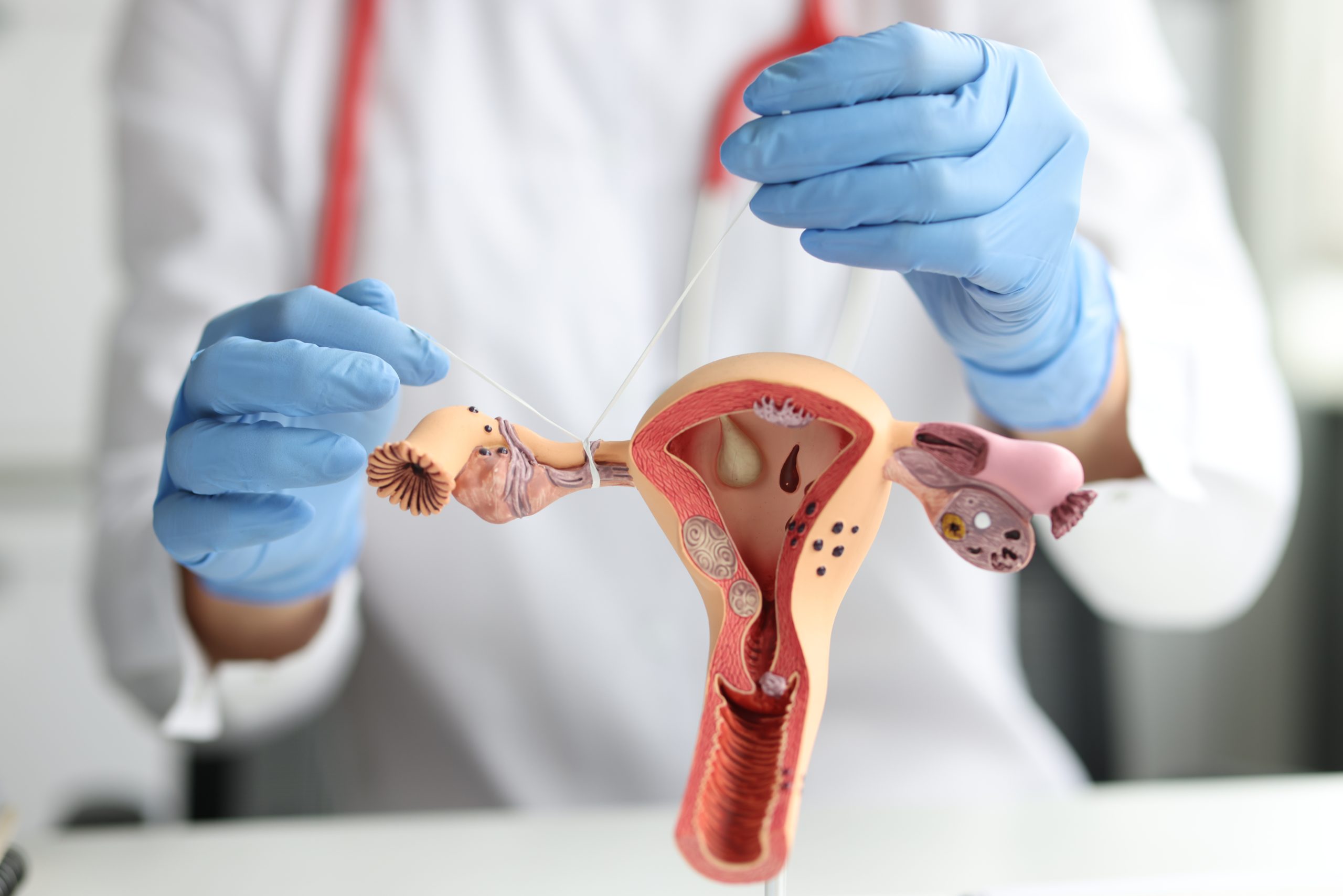 Laqueadura e vasectomia: lei muda importantes regras das esterilizações