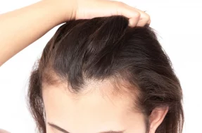 Sofrendo com queda de cabelo? 3 vitaminas te farão ganhar centímetros em dias