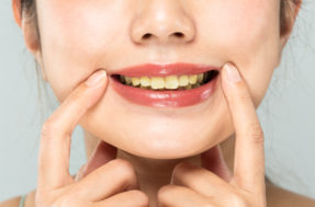 3 cuidados com os dentes que você precisa saber antes que seja tarde demais