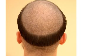 Segredos por trás do corte de cabelo dos monges católicos são REVELADOS; confira
