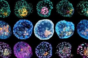 Impressionante! Cientistas criam 1º embrião sintético humano em laboratório