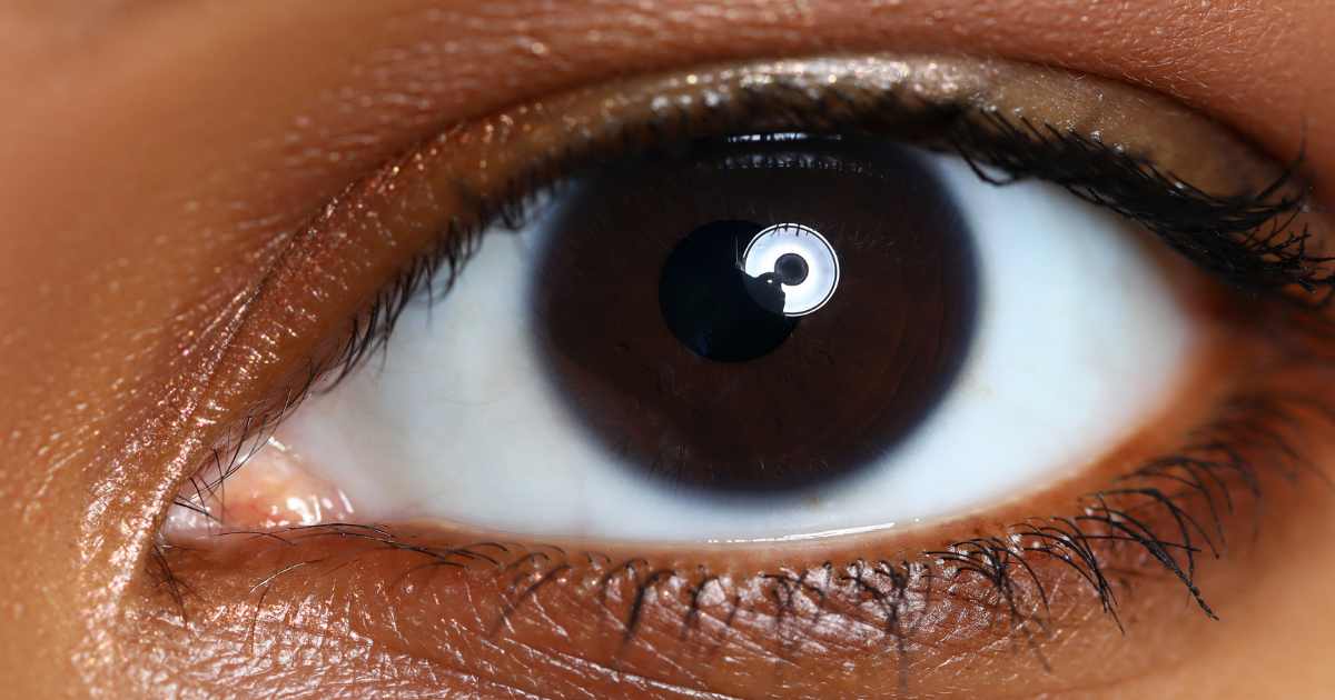 Veja quais são os olhos mais raros que contemplam parte da população