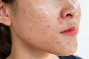 Cara, mas ineficaz: 7 razões para sua skin care não estar funcionando