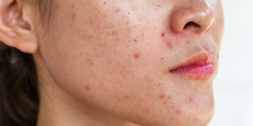 Cara, mas ineficaz: 7 razões para sua skin care não estar funcionando