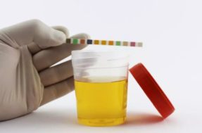 Atenção à cor da sua urina: se estiver assim, procure um médico!